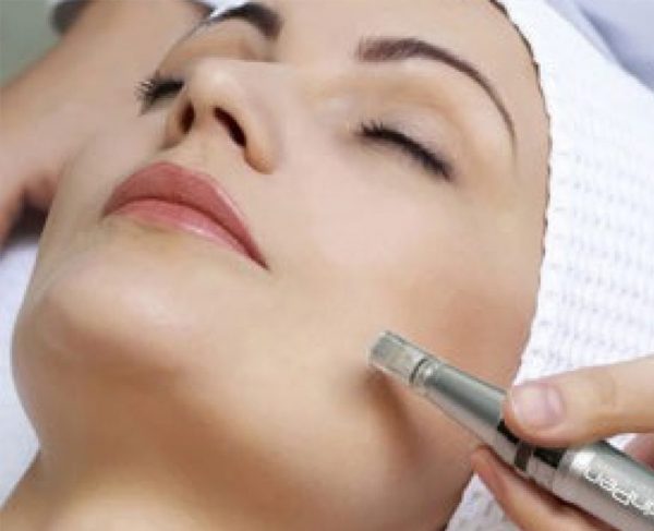 Microneedling Training Course